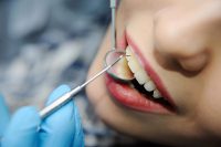 Periodontoloji Ankara